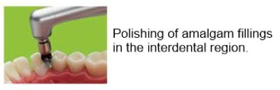 The polishing of amalgam fillings in the interdental region of the mouth.