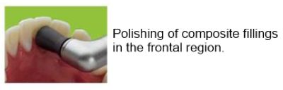The polishing of composite fillings in the frontal region.