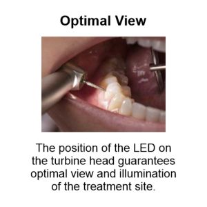 The position of the LED on the turbine head guarantees optimal view and illumination of the treatment site.