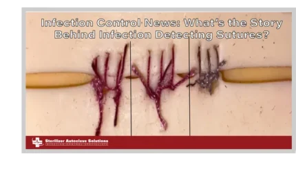 This is the thumbnail for the Infection Control News Article on the story behind beetroot dyed sutures.